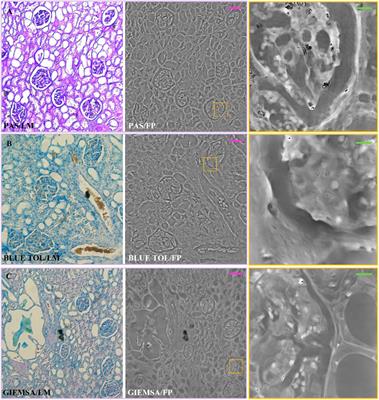 Beyond conventional microscopy: Observing kidney tissues by means of fourier ptychography